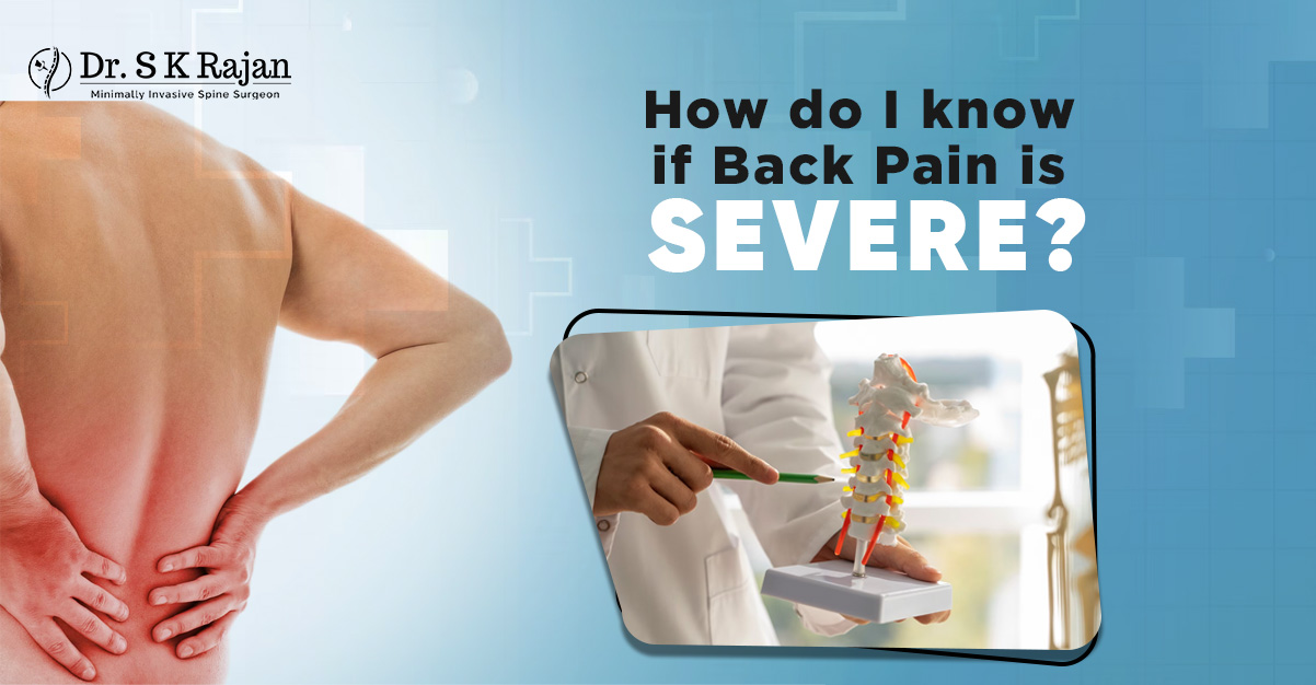 How do I know if back pain is severe